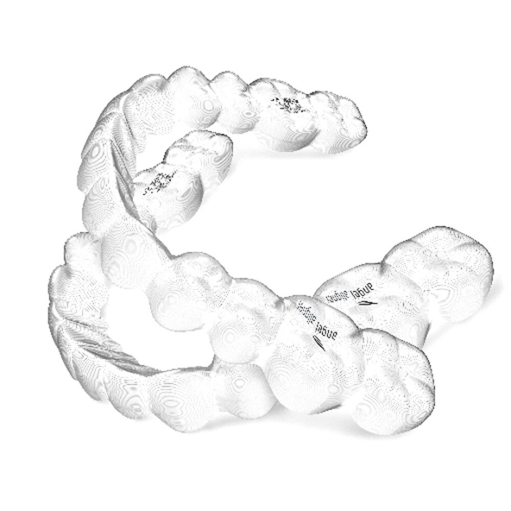 Angel Aligner beugel